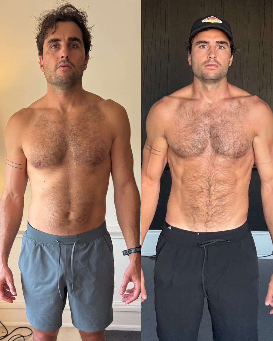 Liam, before and after